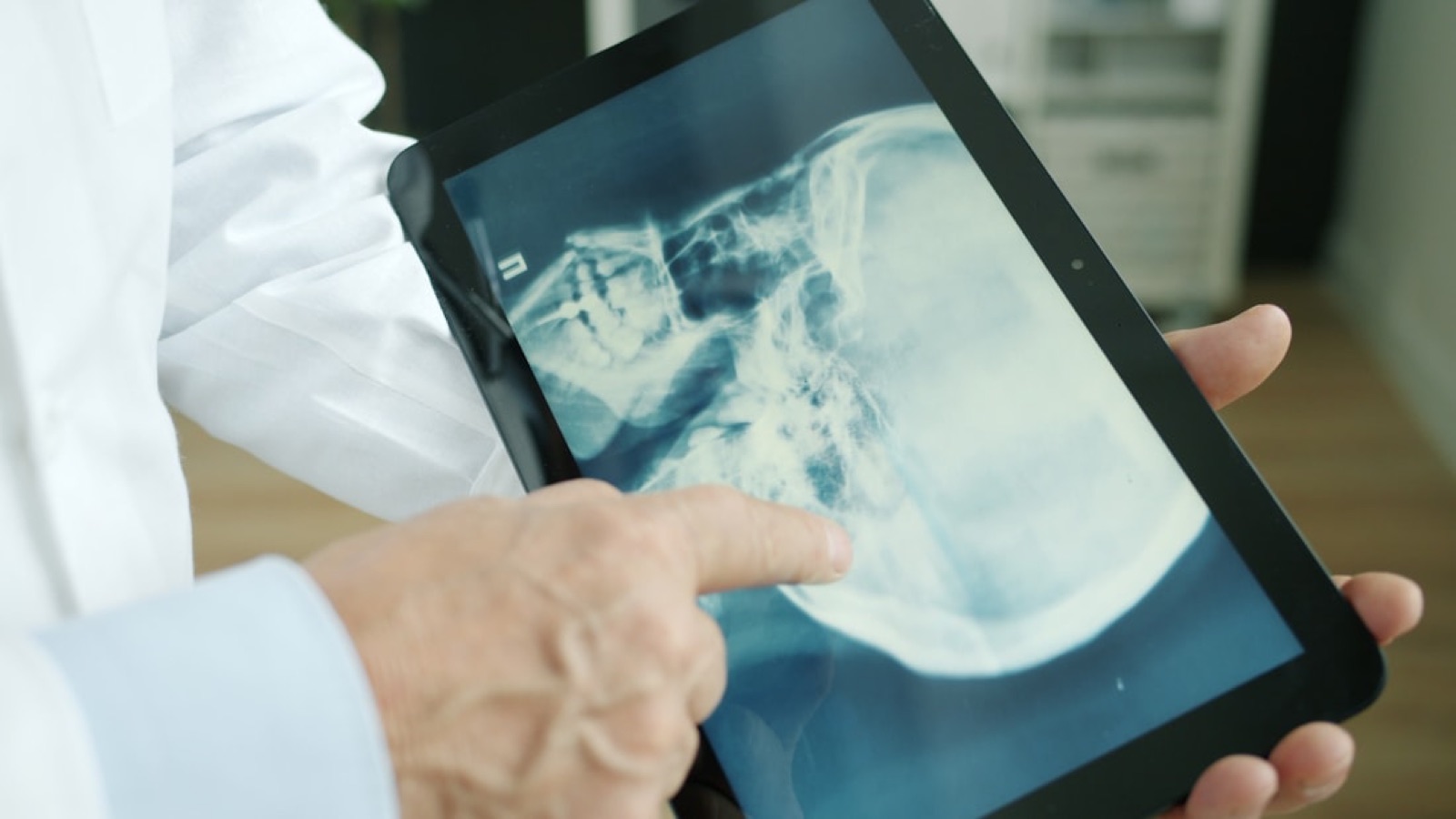 A clinician reviewing a skull X-ray on a tablet